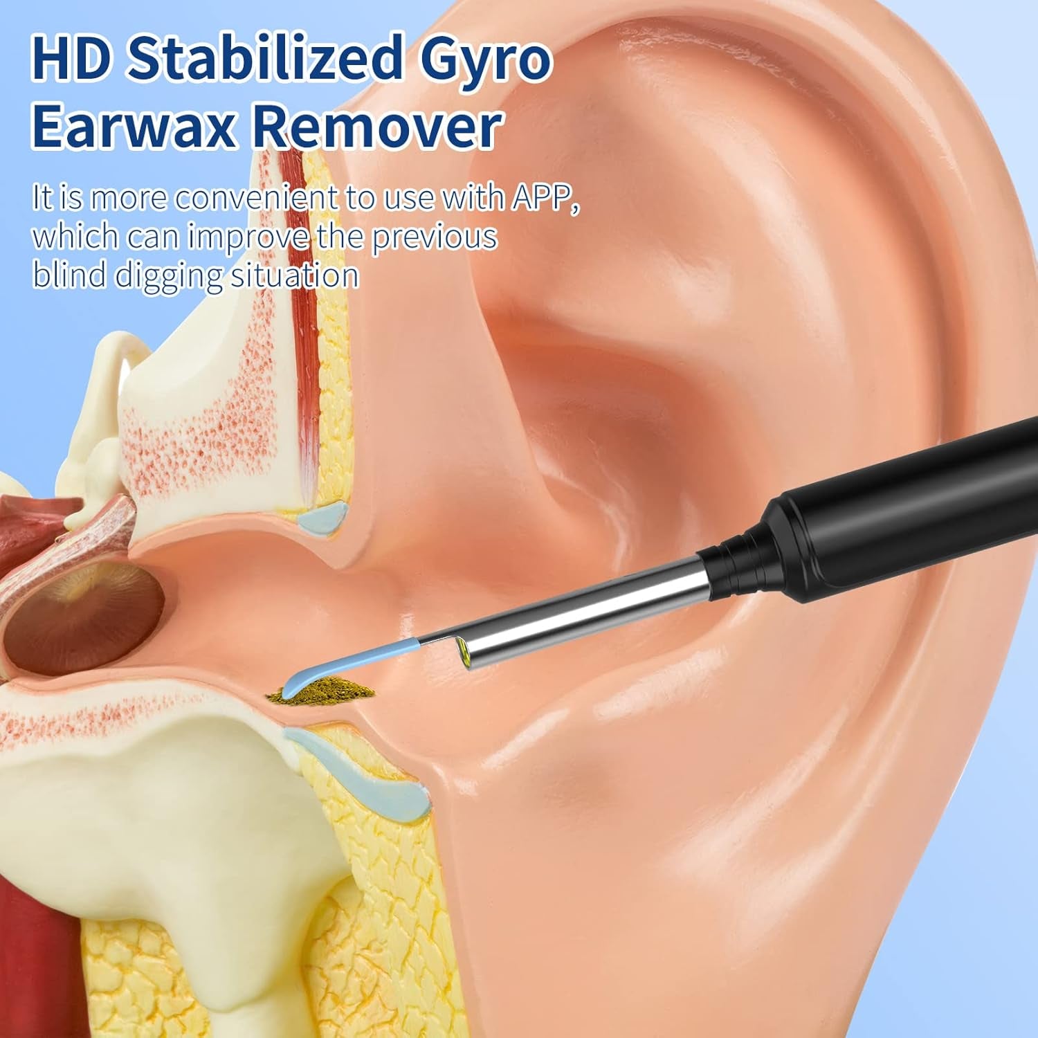 Ear Wax Removal Kit Ear Camera 1296P High-Definition Earwax Cleaner Portable USB Charging Visible 6 LED Otoscope for Iphone, Ipad, Android
